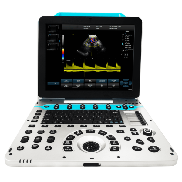 Wholesale Portable Vet Ultrasound Machine for Small & Large Animals 3