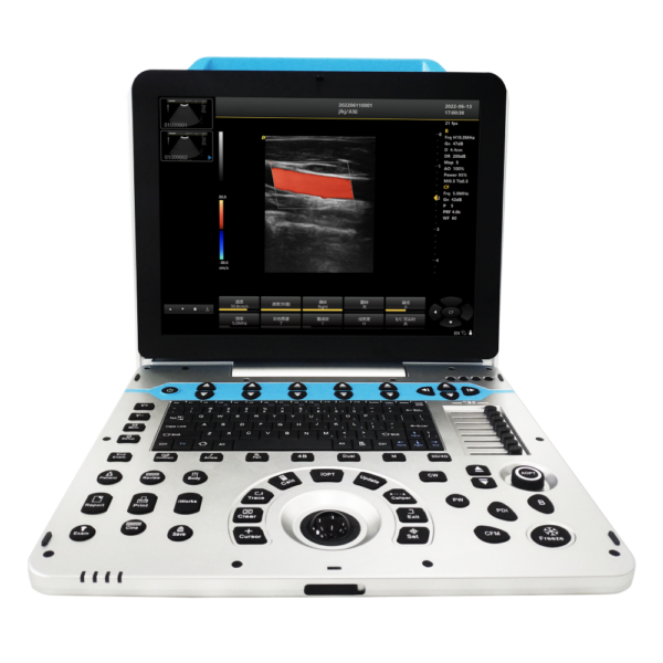 Wholesale Portable Vet Ultrasound Machine for Small & Large Animals 4