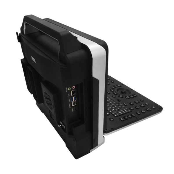 Best Portable Veterinary Ultrasound Machine with Color Doppler, Elastography, and Auto IMT - Image 4