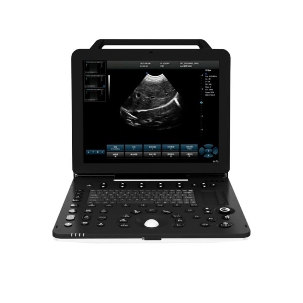 Best Portable Veterinary Ultrasound Machine with Color Doppler, Elastography, and Auto IMT - Image 2