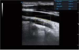 APV-8T Advanced Veterinary Ultrasound System with Doppler, Elastography, and TDI for Cardiac and Abdominal Imaging 10