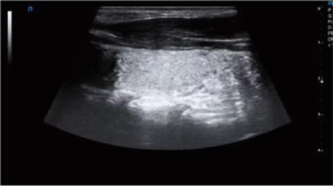APV-8T Advanced Veterinary Ultrasound System with Doppler, Elastography, and TDI for Cardiac and Abdominal Imaging 12
