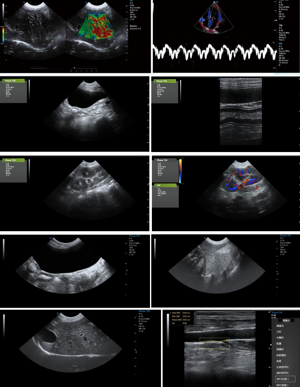 Advanced veterinary ultrasound system with Doppler for cardiac and abdominal imaging