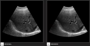 APV-8T Advanced Veterinary Ultrasound System with Doppler, Elastography, and TDI for Cardiac and Abdominal Imaging 7