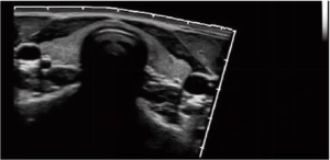APV-8T Advanced Veterinary Ultrasound System with Doppler, Elastography, and TDI for Cardiac and Abdominal Imaging 8