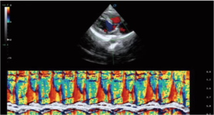 APV-8T Advanced Veterinary Ultrasound System with Doppler, Elastography, and TDI for Cardiac and Abdominal Imaging 9
