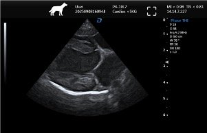 Apical Four-Chamber Long-Axis View (Right Lateral Decubitus Position)