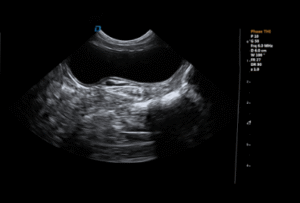 Transverse bladder ultrasound image in small animal patient