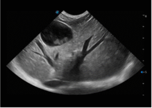 Veterinary ultrasound image of canine liver parenchyma