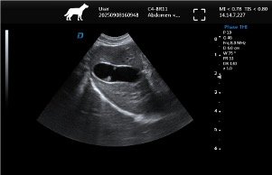 Gallbladder – Micro-Convex Probe, Longitudinal View