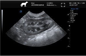 Left Kidney – Micro-Convex Probe, Cross-Sectional View